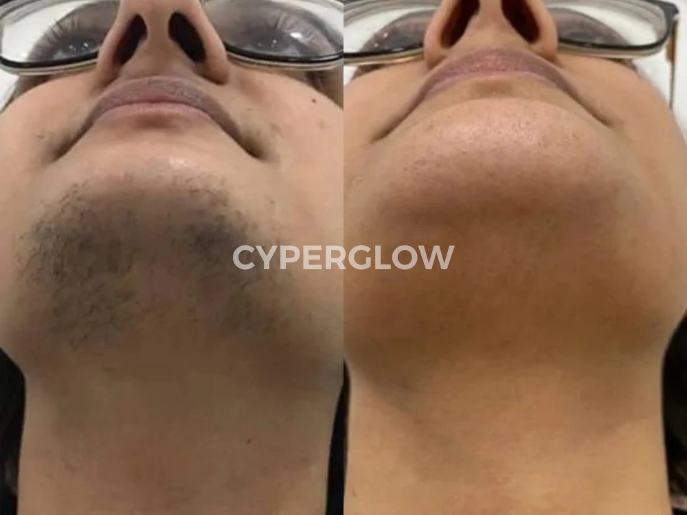 Chin paired photographs published with Nisha E. review