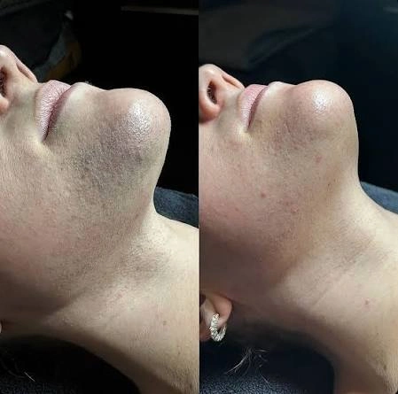 User-supplied paired chin and neck photographs